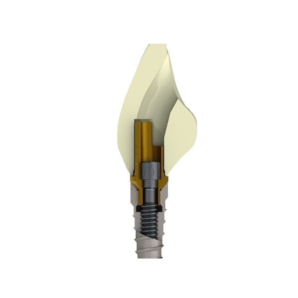 Implant and ti Base 2